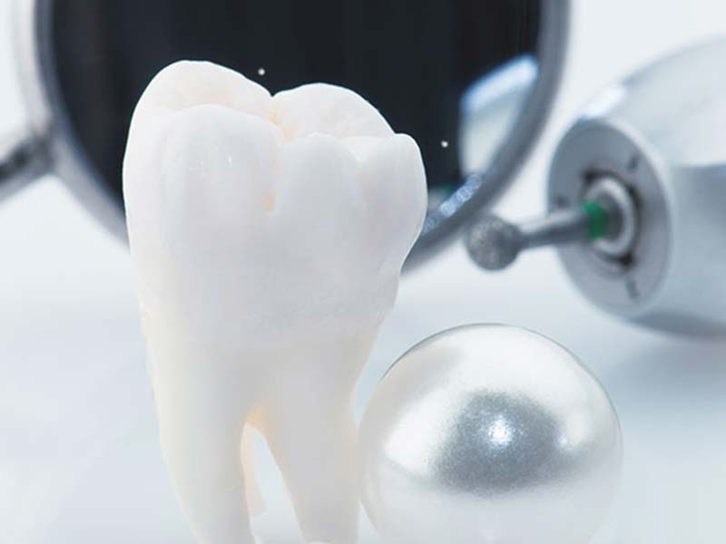 高階美學樹脂補牙