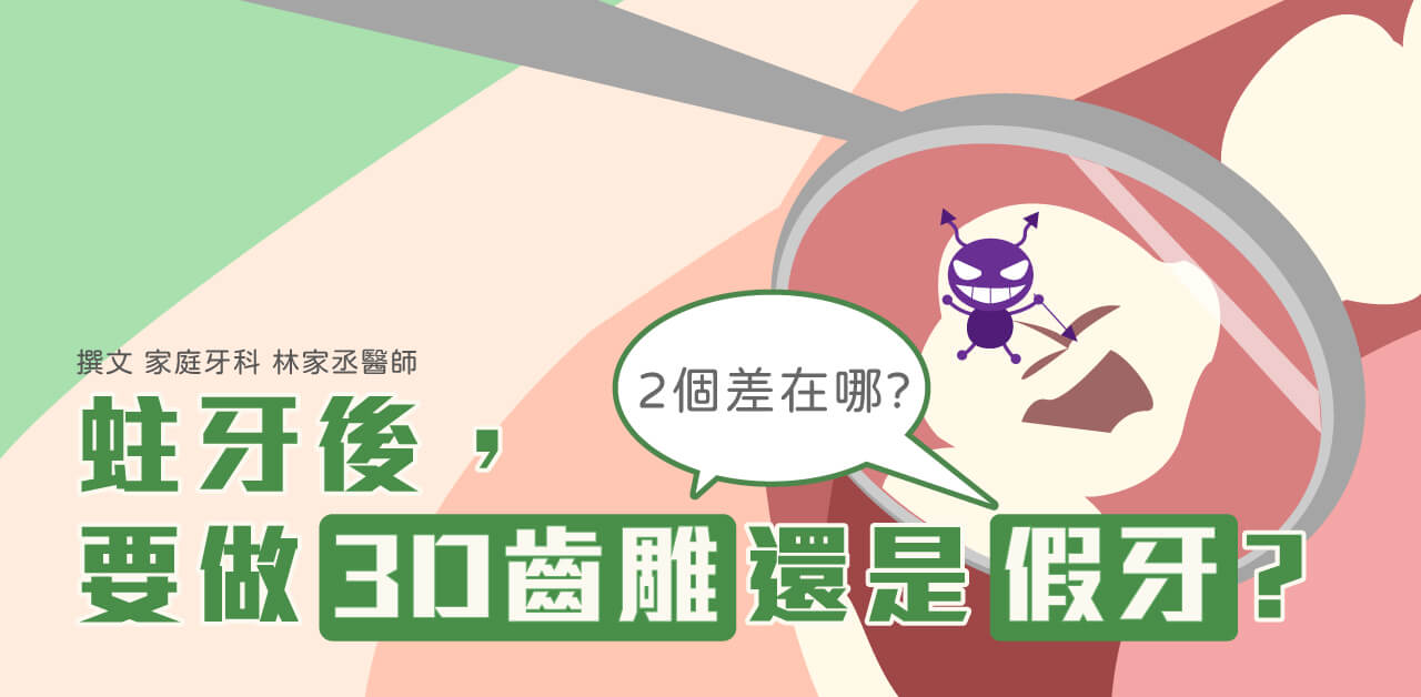 蛀牙後，要做3D齒雕或假牙？兩個差在哪？