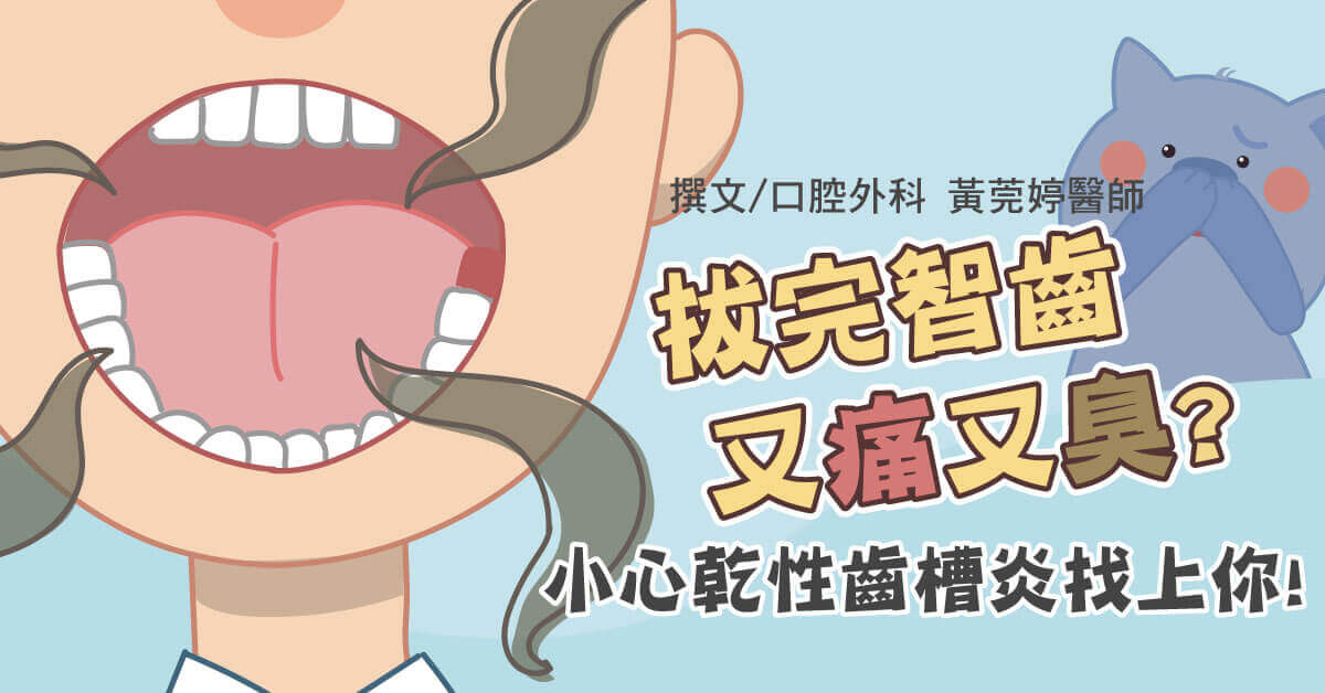 拔完智齒洞很臭？小心乾性齒槽炎找上你！常見症狀與治療方式一次看