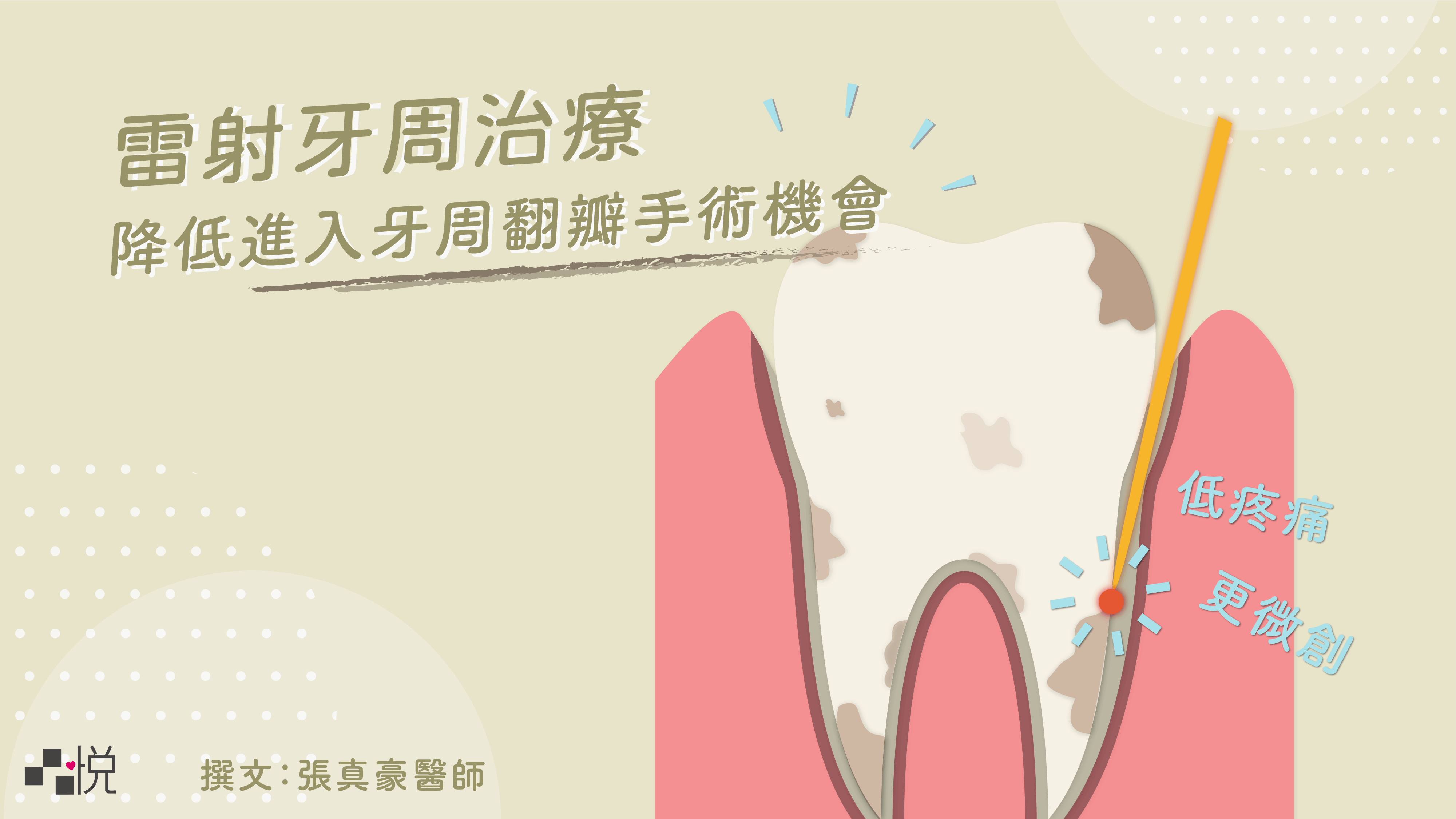 牙周病不治療有影響嗎？微創雷射牙周治療低疼痛、傷口小、恢復佳