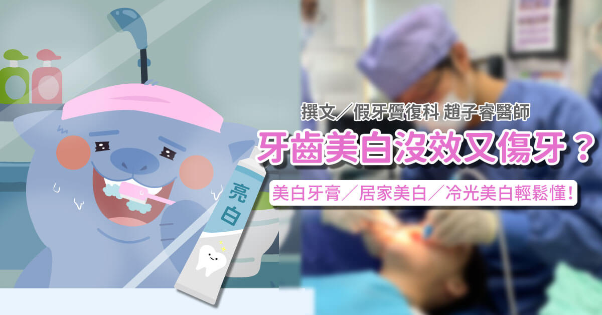 怕美白牙齒沒效又傷牙？醫分析美白牙膏/居家美白/冷光美白輕鬆懂