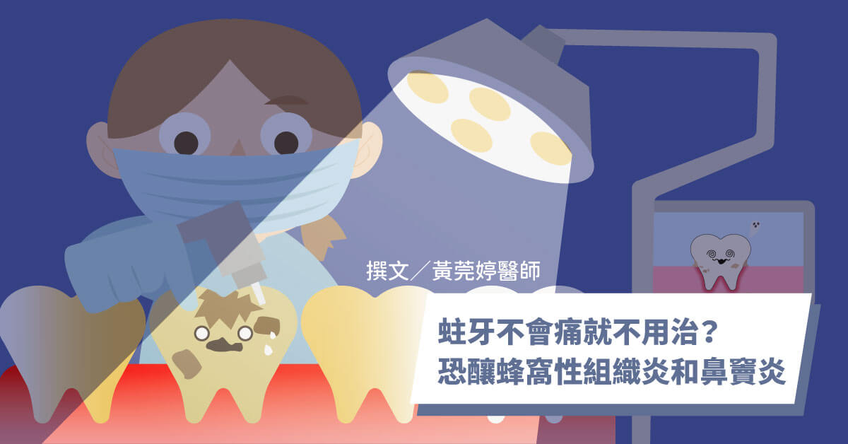 蛀牙不會痛就不用治療吧？！醫提醒恐釀蜂窩性組織炎和鼻竇炎、真實案例解析