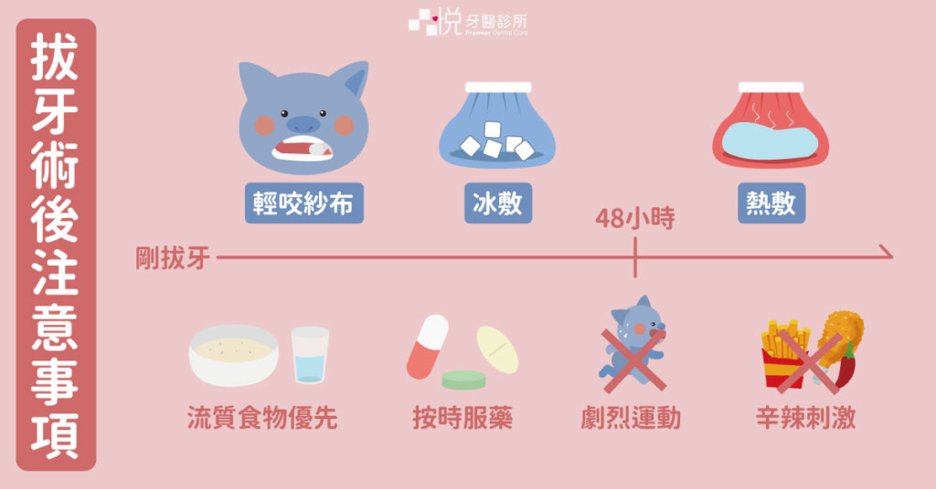拔智齒後注意事項