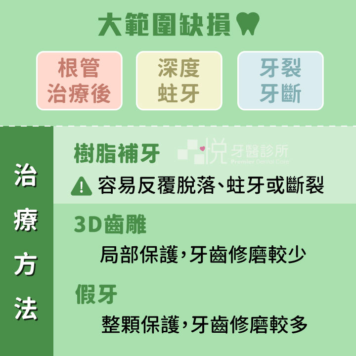 大範圍缺損的牙齒治療後建議要將齒質好好保護起來,才不容易二度蛀牙或是引起牙裂牙斷。
