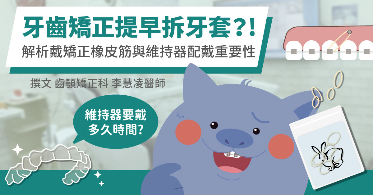 牙齒矯正如何提早拆牙套？解析戴矯正橡皮筋與維持器配戴重要性