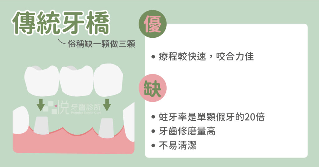 傳統牙橋適合不想手術又咬合力大的患者,但是非常容易蛀牙且左右兩邊牙齒需要磨掉非常大一部分。