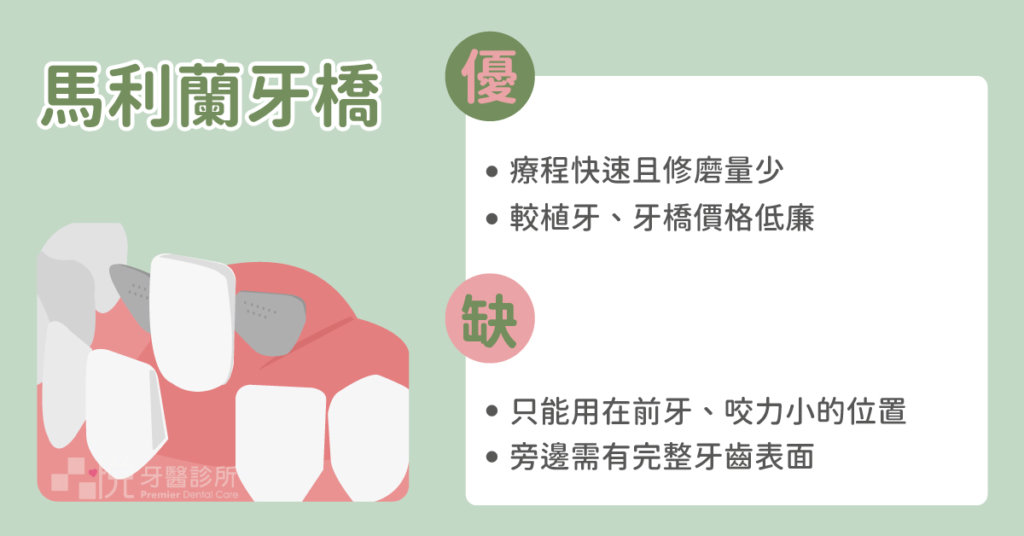 馬利蘭牙橋修磨量少且快速,但是只能使用在前牙或承受咬合力小的部位。