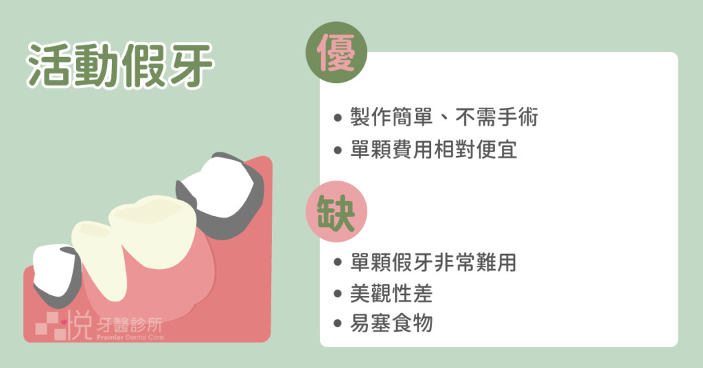 活動假牙製作簡單快速且不需手術,但是尤其單顆假牙非常難用,不僅咬合承受力差、食物容易卡牙縫,還有脫落、噴出的風險。