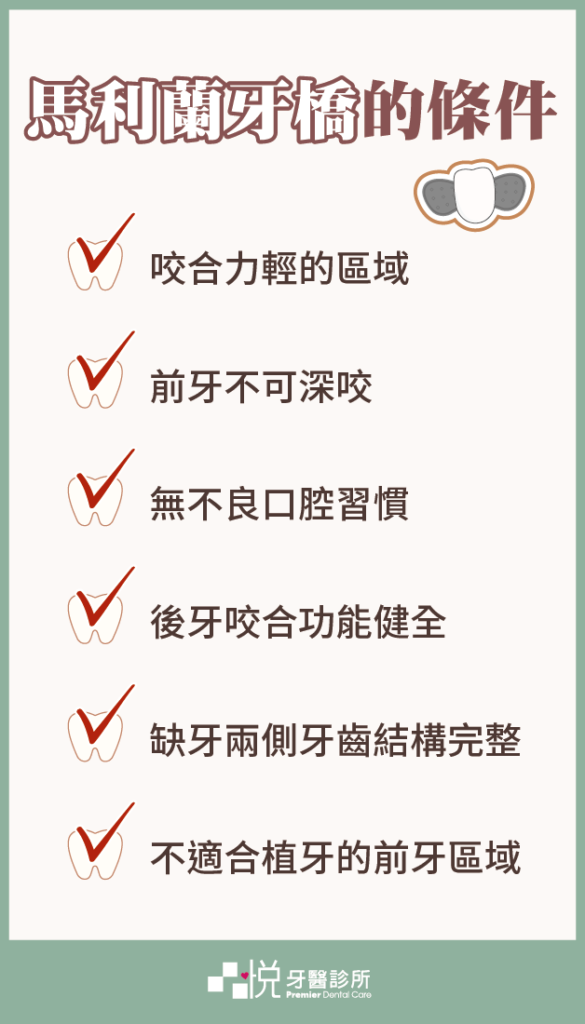 黏著式牙橋(馬利蘭牙橋)的條件:咬合力清、不可深咬、無不良口腔習慣、後牙咬合功能健全、不適合植牙的前牙區域