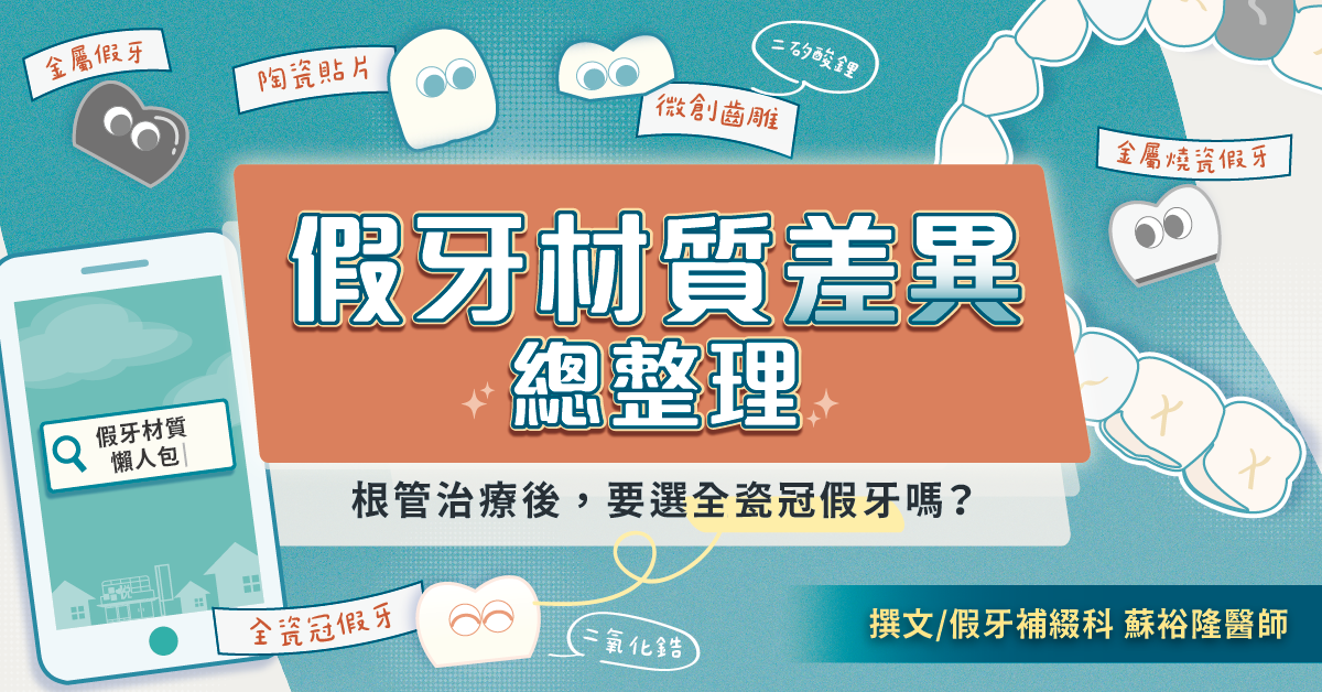 2026假牙材質差異總整理｜根管治療後，要選全瓷冠假牙嗎？