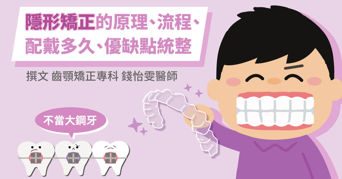 不當大鋼牙！隱形矯正的原理、流程、配戴多久、優缺點統整
