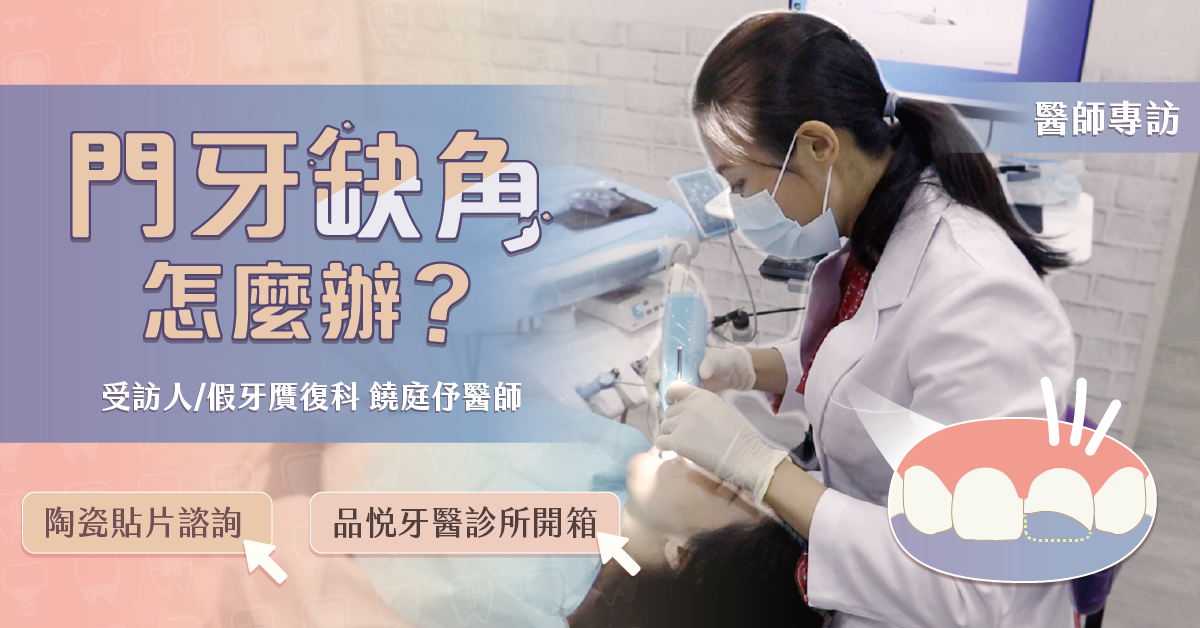 門牙缺角怎麼辦？陶瓷貼片諮詢與品悅牙醫診所開箱【竹北陶瓷貼片推薦】