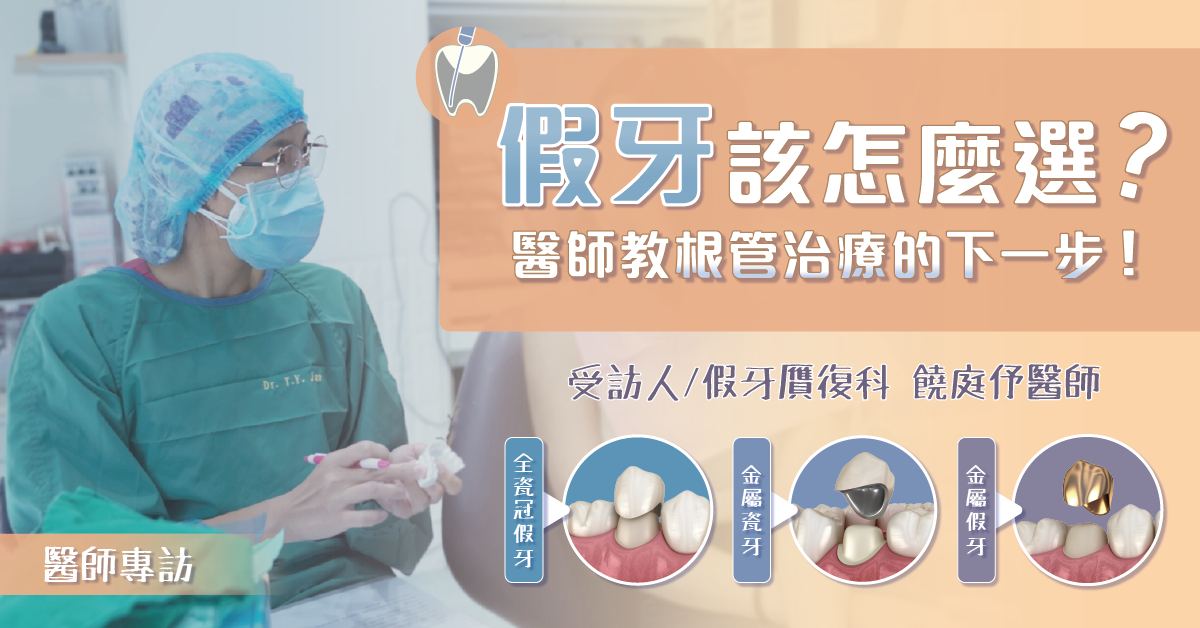 假牙該怎麼選？醫師教根管治療的下一步，保護自己的牙齒！【竹北假牙推薦】