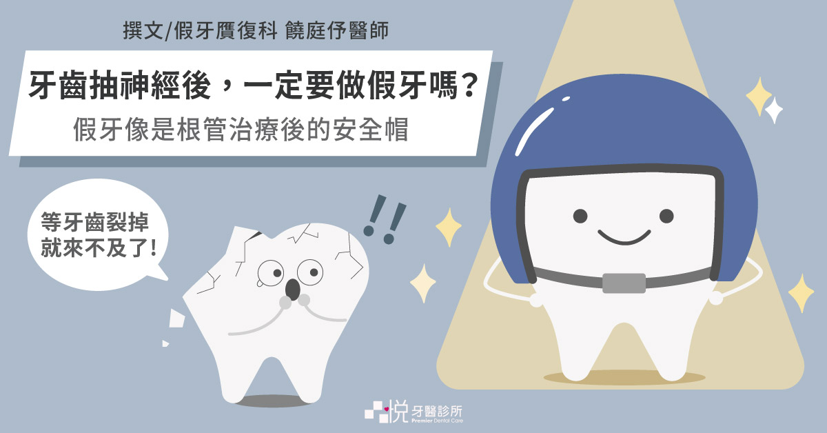 牙齒抽神經後，一定要套假牙嗎？假牙像是根管治療後的安全帽