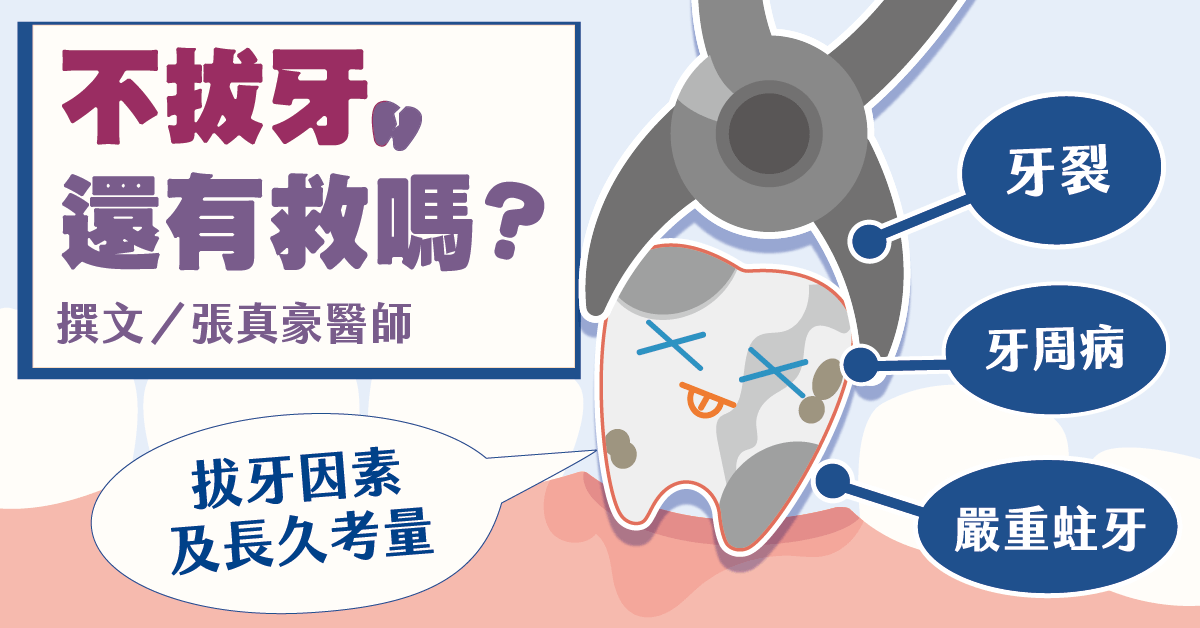 不拔牙還有救嗎？「牙裂、嚴重蛀牙、牙周病」拔牙因素及長久考量