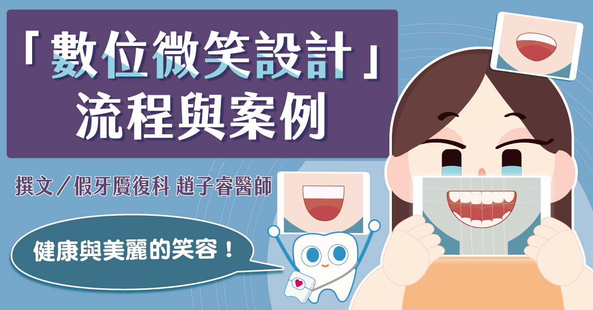 健康與美麗兼具的笑容！淺談「數位微笑設計」流程與案例