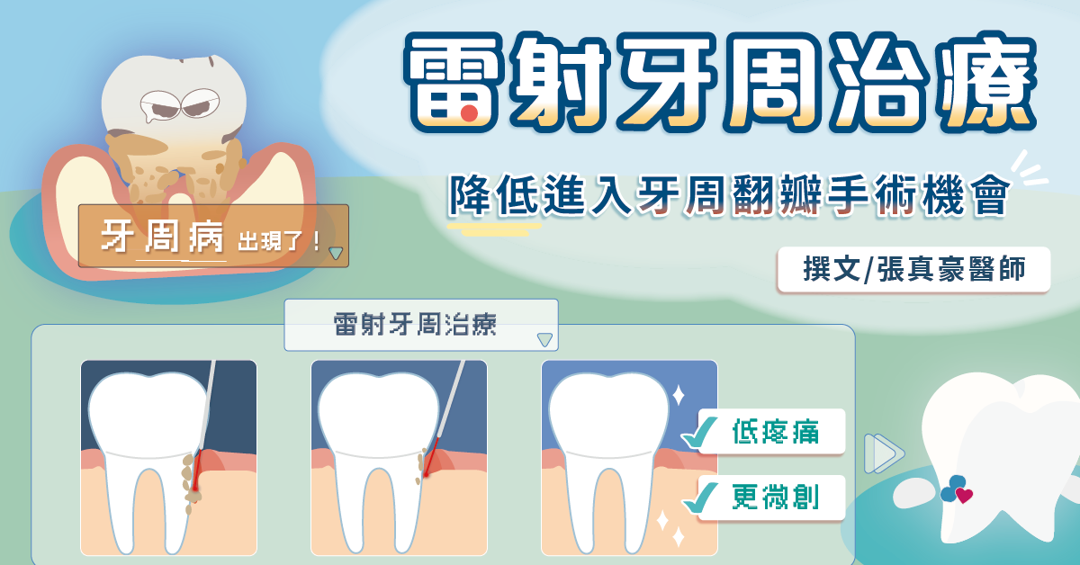 牙周病不治療有影響嗎？微創雷射牙周治療低疼痛、傷口小、恢復佳