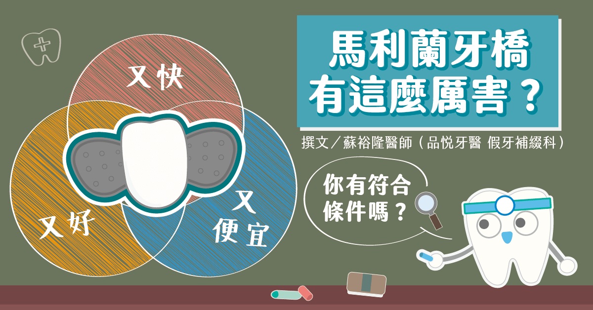 「馬利蘭牙橋」更快更好更便宜？有這種好牙橋哪裡找？