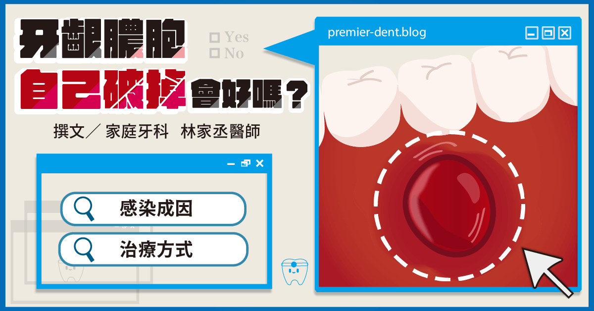 牙齦膿包自己破掉會好嗎？牙醫解析細菌感染成因與治療方式