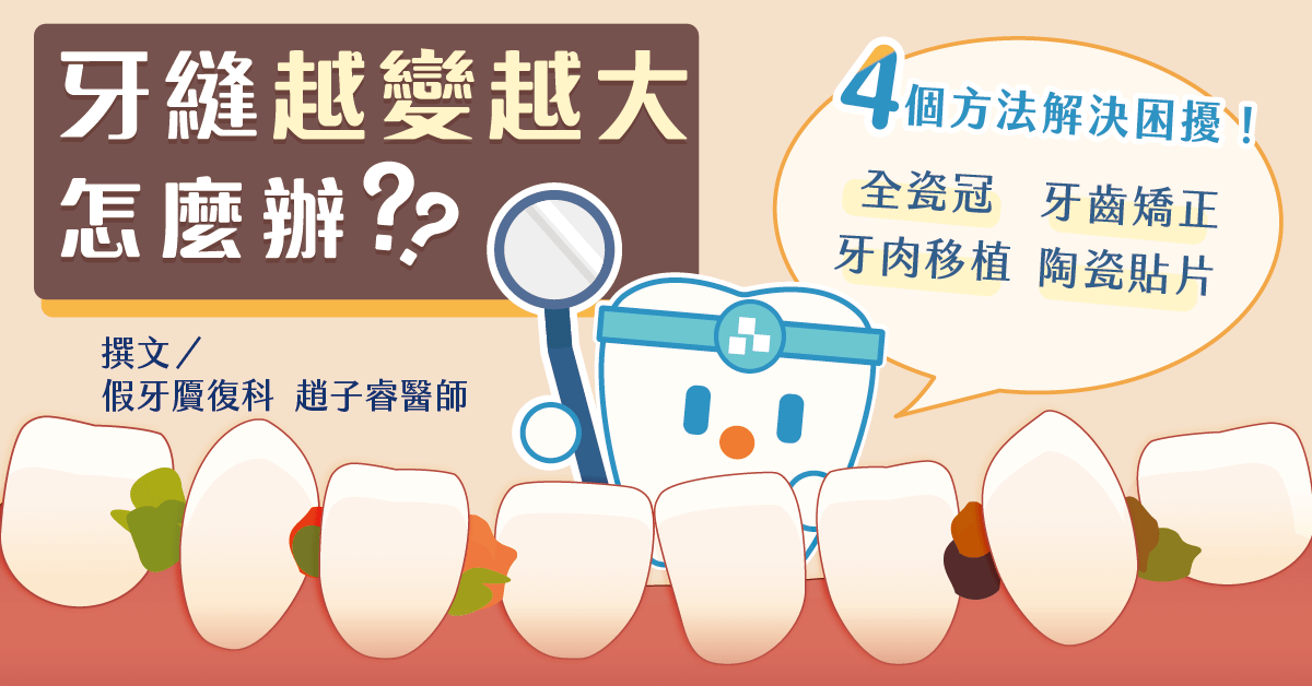 牙縫越變越大卡菜渣怎麼辦？四個方法解決你的困擾