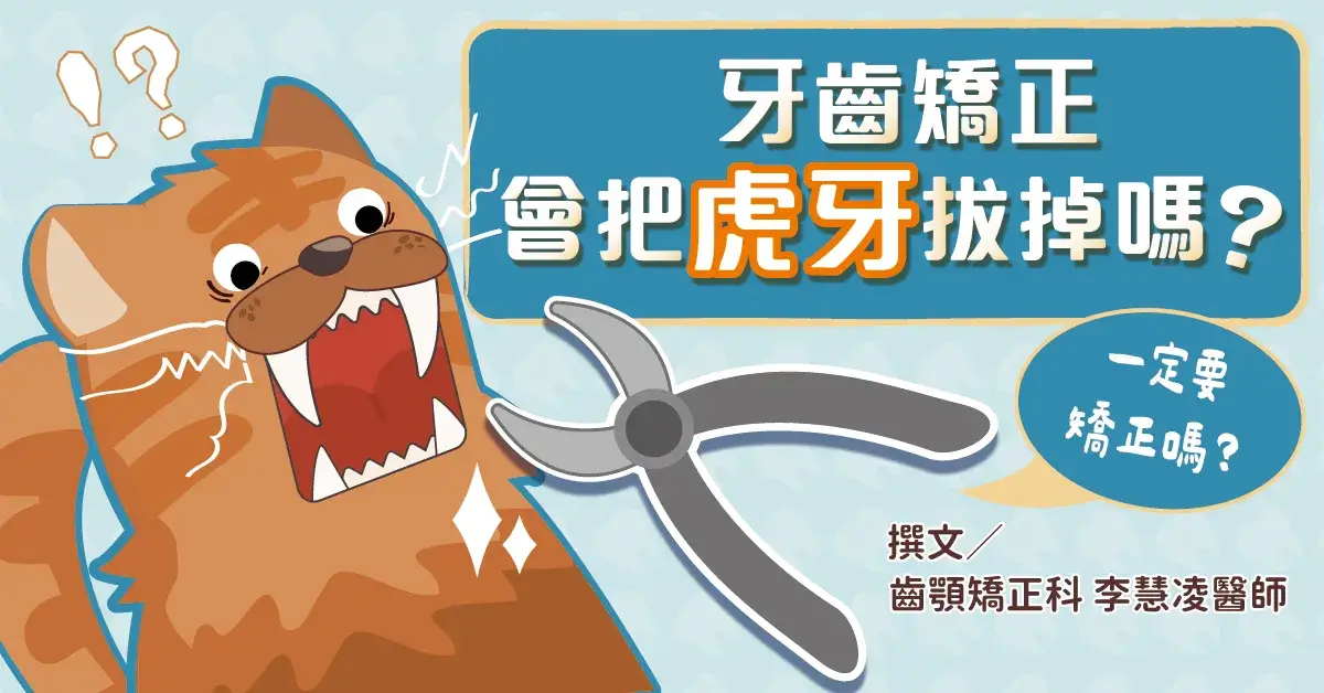 矯正虎牙要拔牙嗎？不矯正會怎樣？咬合問題、蛀牙風險你要知道