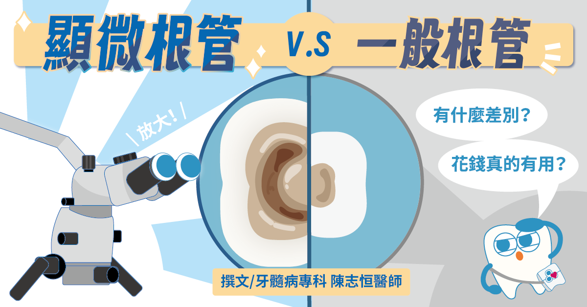 顯微鏡根管 vs 一般根管治療的差異？花錢真的就能成功嗎？