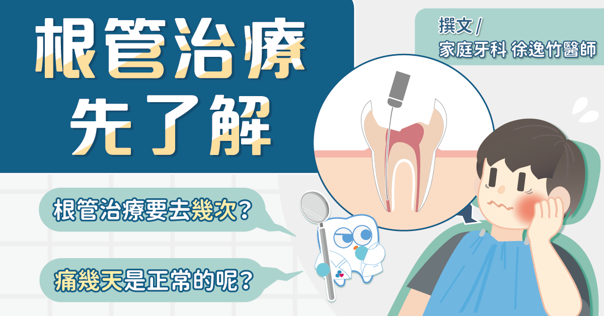 根管治療前先了解：根管治療要幾次？牙齒抽神經會痛幾天？！