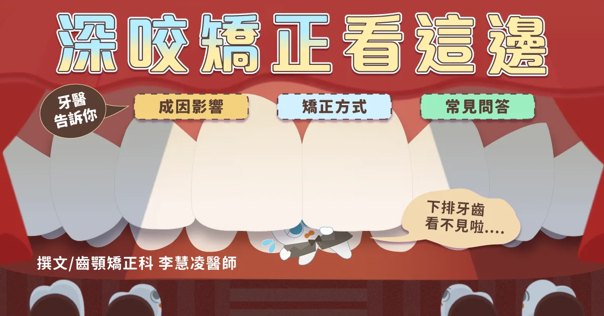 深咬矯正看這篇！牙醫剖析深咬成因影響、矯正方式比較、常見問答