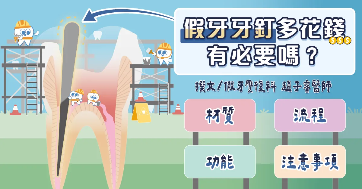 假牙牙釘多花錢有必要嗎？牙釘的材質與功能、治療流程、注意事項