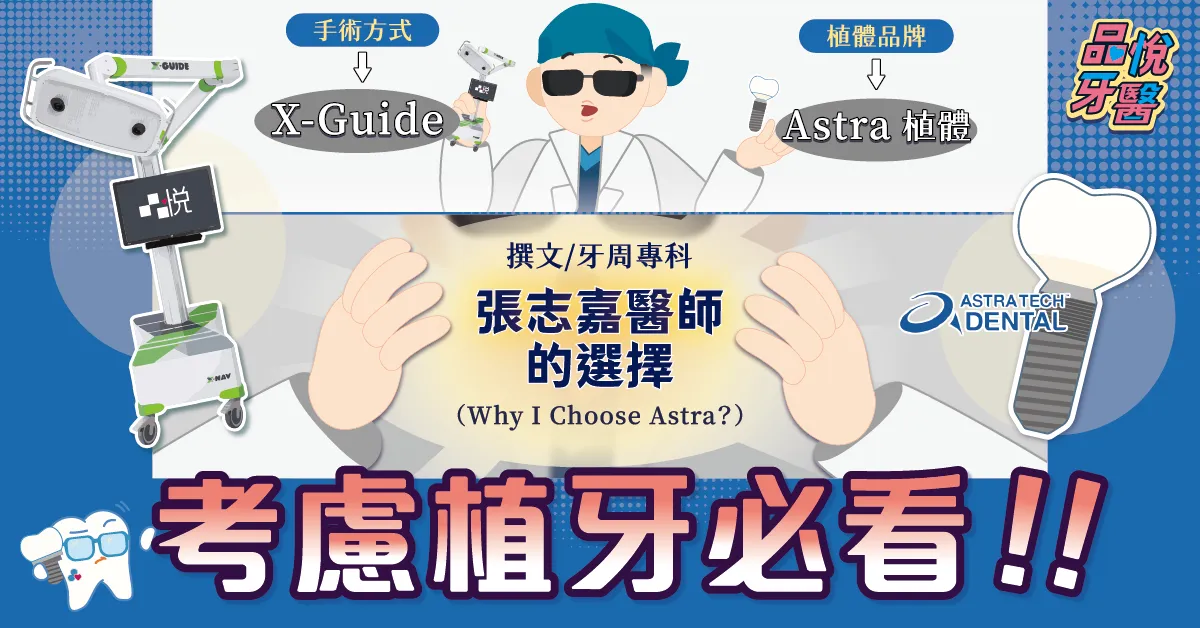 考慮植牙必看！導航式植牙 VS 傳統植牙差異＋Astra植體完整說明
