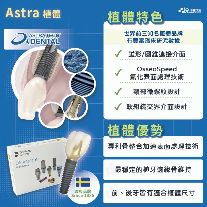 Astra植體的優勢與特色