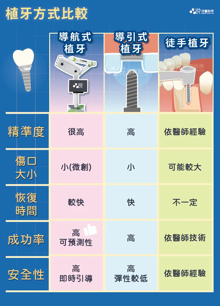 X-Guide導航式植牙 VS 導引式植牙 VS 傳統徒手植牙