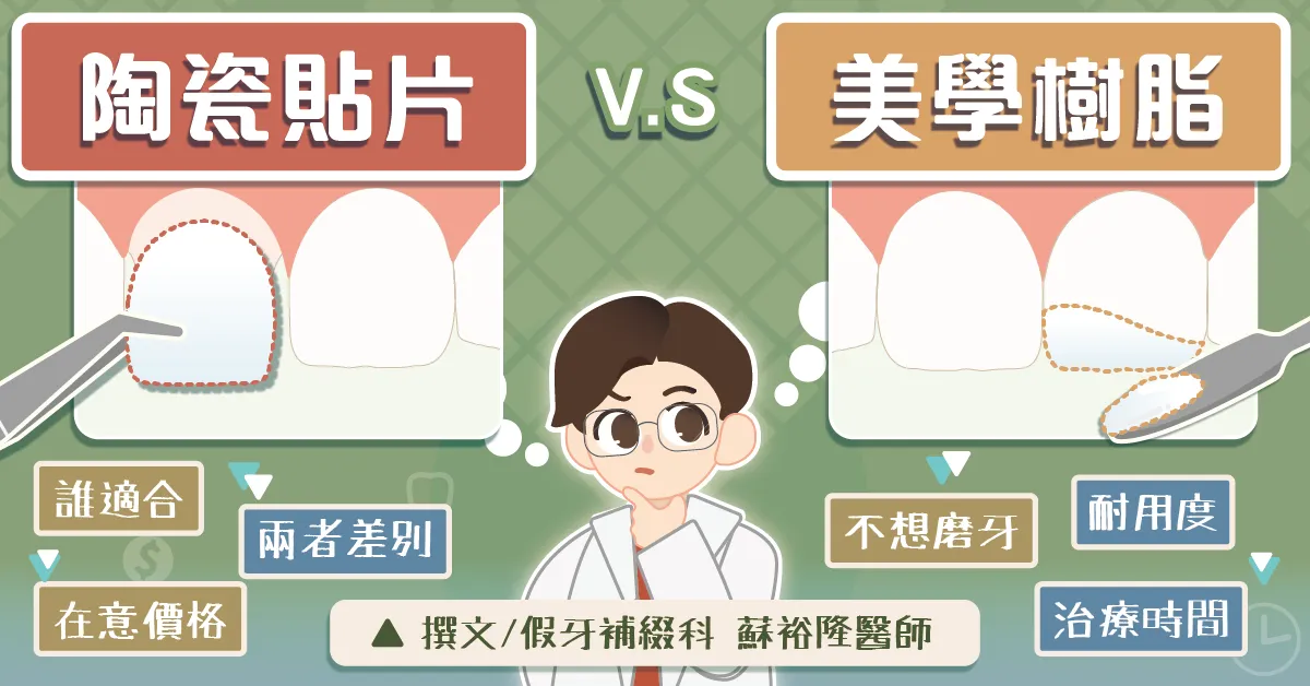 陶瓷貼片VS美學樹脂｜全收錄：怎麼選/磨牙量/耐用度/價格比較