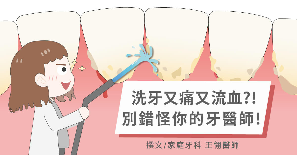 洗牙會痛會流血！？多久洗牙一次才能保持牙齒健康？