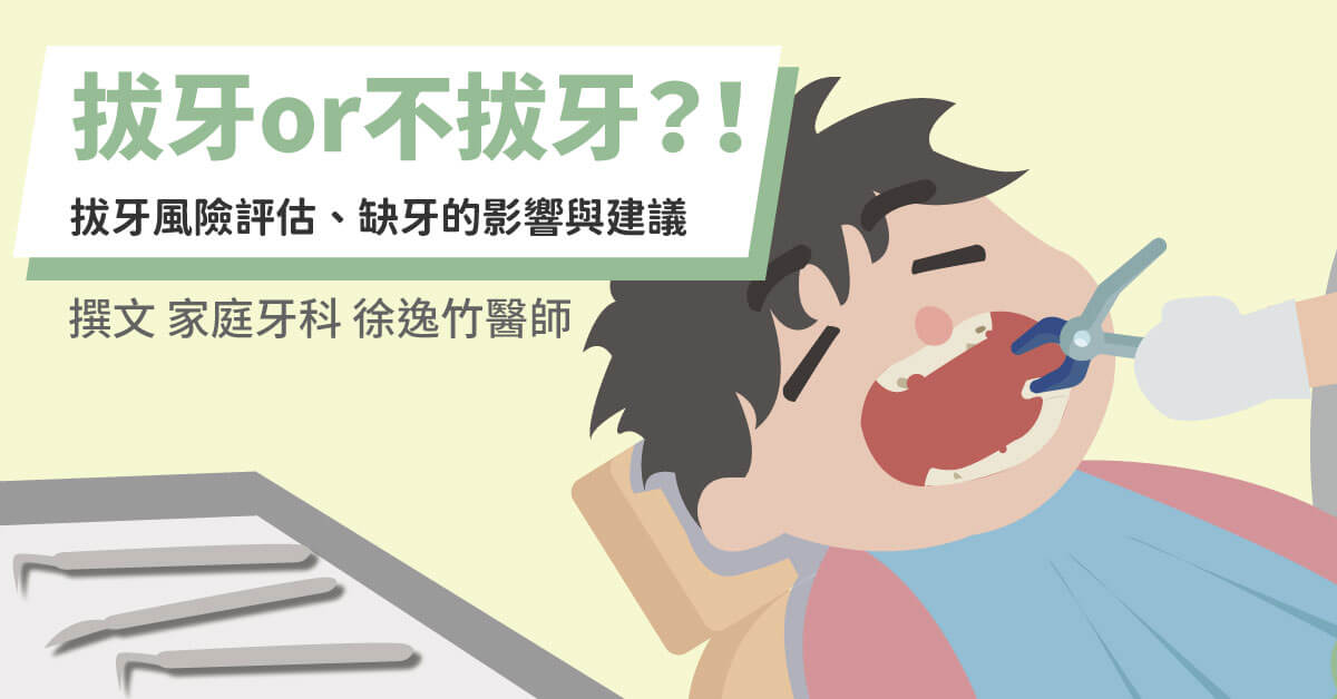 【不想拔牙看這篇！】拔牙與不拔牙的風險評估、缺牙的影響與建議
