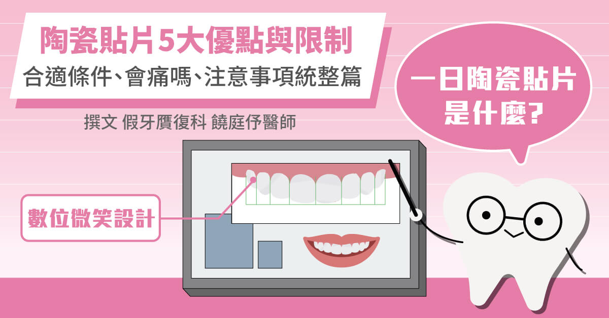 陶瓷貼片５大優點與限制！合適條件、會痛嗎、注意事項統整篇