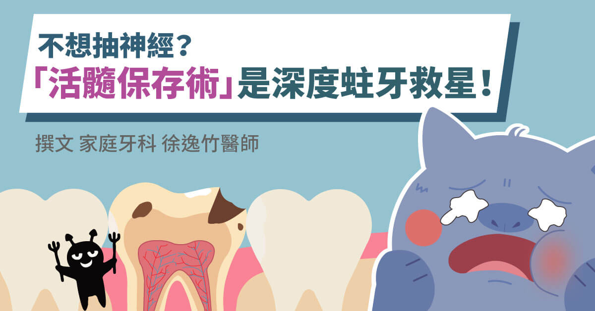 不想抽神經？「活髓保存術」是深度蛀牙救星！