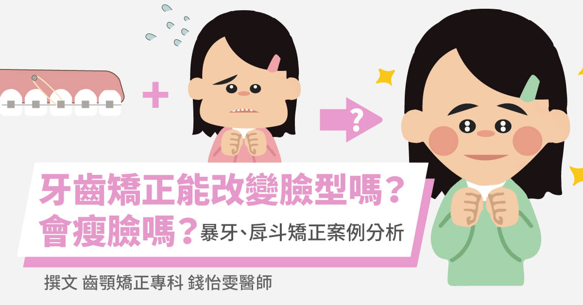 牙齒矯正能改變臉型嗎？會瘦臉嗎？暴牙、戽斗矯正案例分析