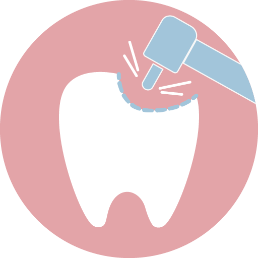 客製化牙齒缺損部分
