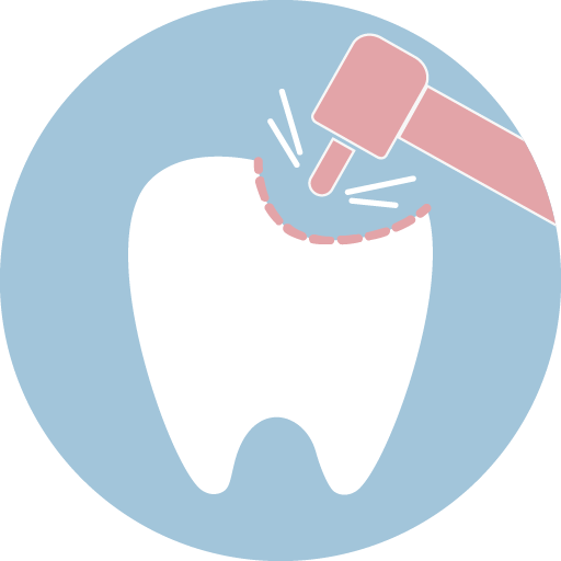 客製化牙齒缺損部分