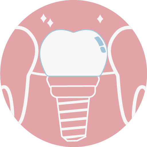 植牙假牙採全瓷冠材質