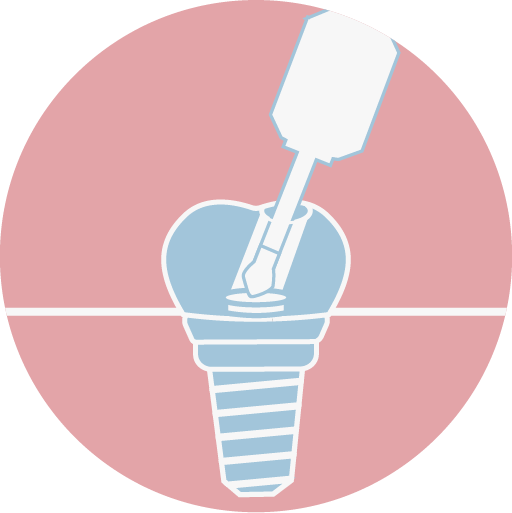 螺絲固持式假牙