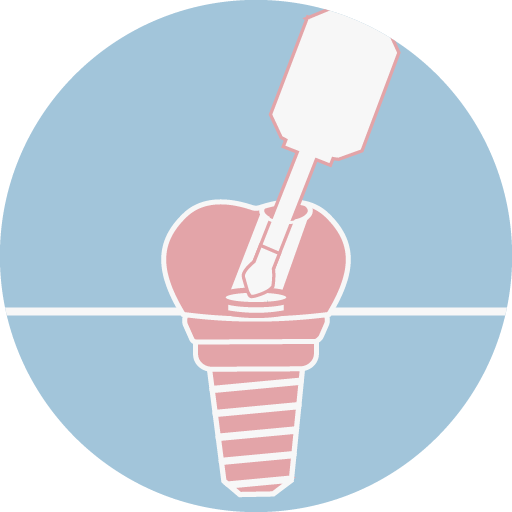 螺絲固持式假牙