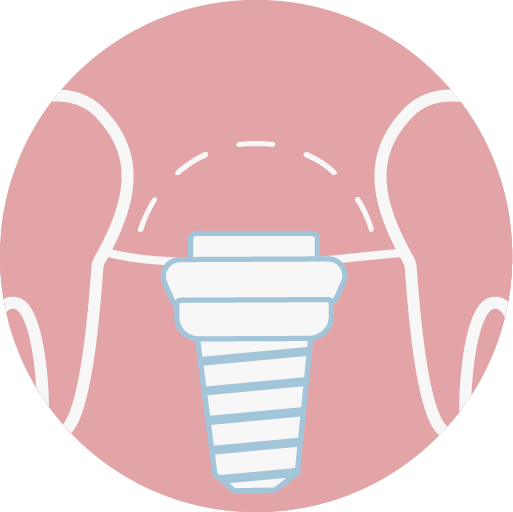 嚴選國內外植體大廠牌