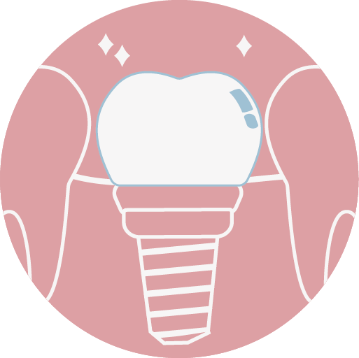 植牙假牙採全瓷冠材質