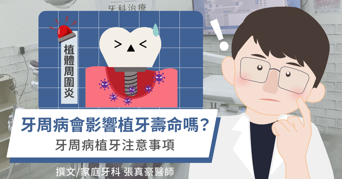 牙周病會影響植牙壽命嗎？牙周病植牙注意事項