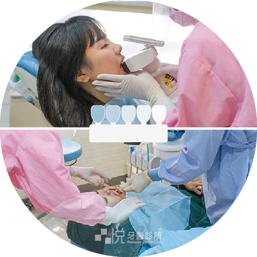 ❷ 牙齒比色、拍攝口內照片、量化美白效果