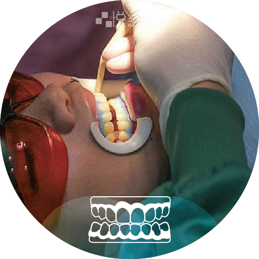 ❸ 塗牙齦保護劑