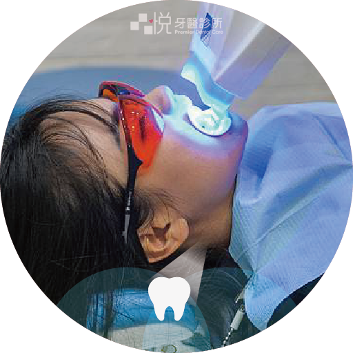 ❹ 開始進行冷光美白（約1小時）