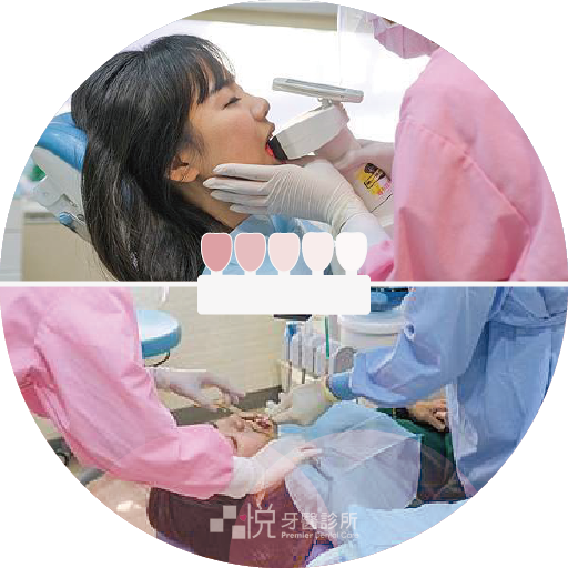 ❷ 牙齒比色、拍攝口內照片、量化美白效果